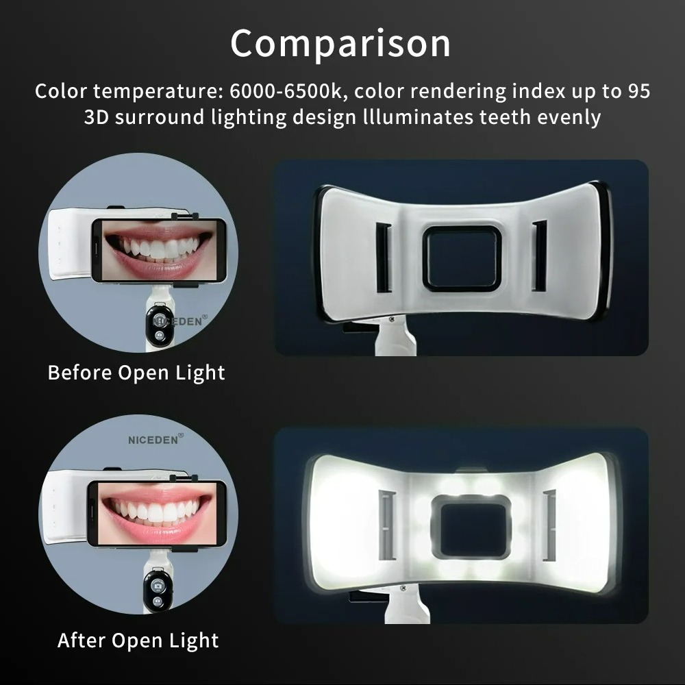 Dental Photography Light Phone - đánh giá và giá Photography Lighting Accessories