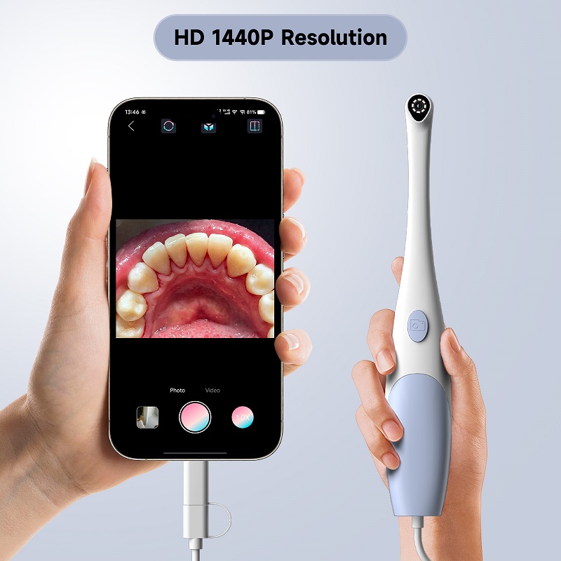 Oral Endoscope Camera 1440P Ph - đánh giá và giá Photography Lighting Continuous
