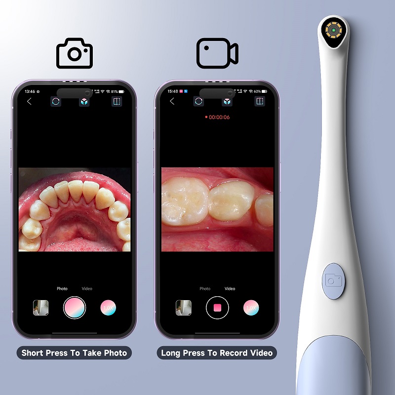 Oral Endoscope Camera 1440P Ph - đánh giá và giá Photography Lighting Continuous